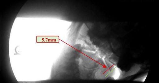 Digital Motion X-ray imaging