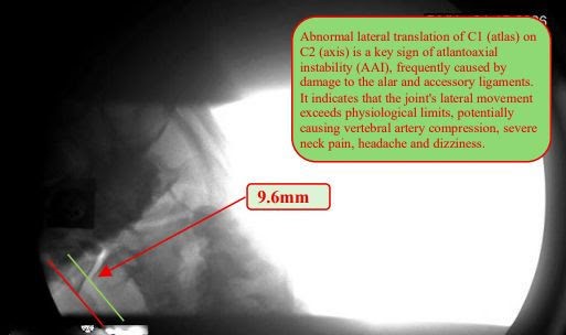 Digital Motion X-ray imaging