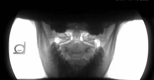 Digital Motion X-ray in motion